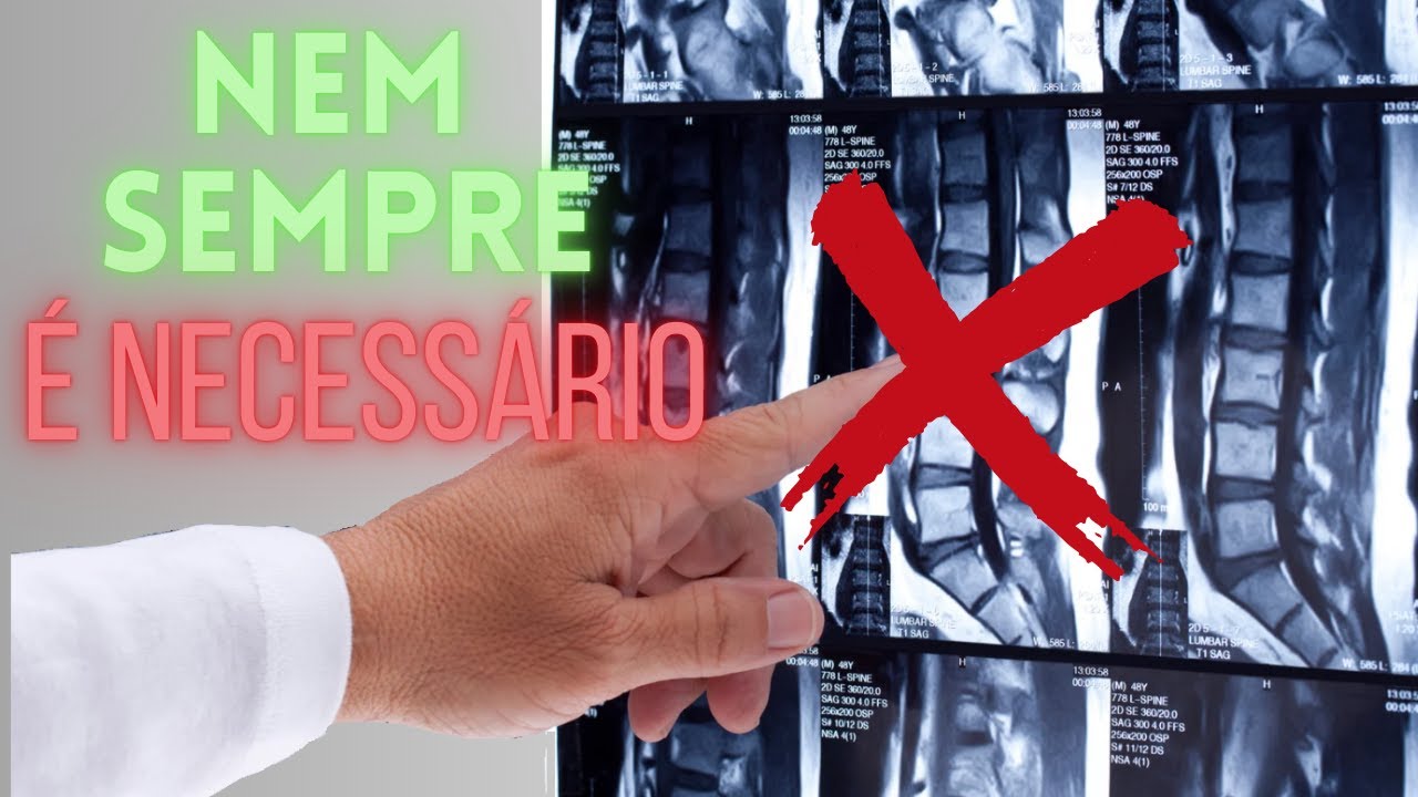 👉 Dor Lombar: Quando Realmente Fazer Exame de Imagem?