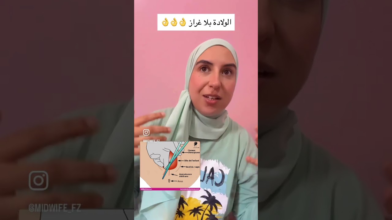 الولادة بدون شق عجان /بلا غراز الحل عندك