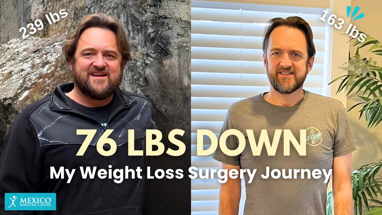I LOST 76 POUNDS! | Sharing my Weight Loss Journey with Duodenal Switch (SADI-S)