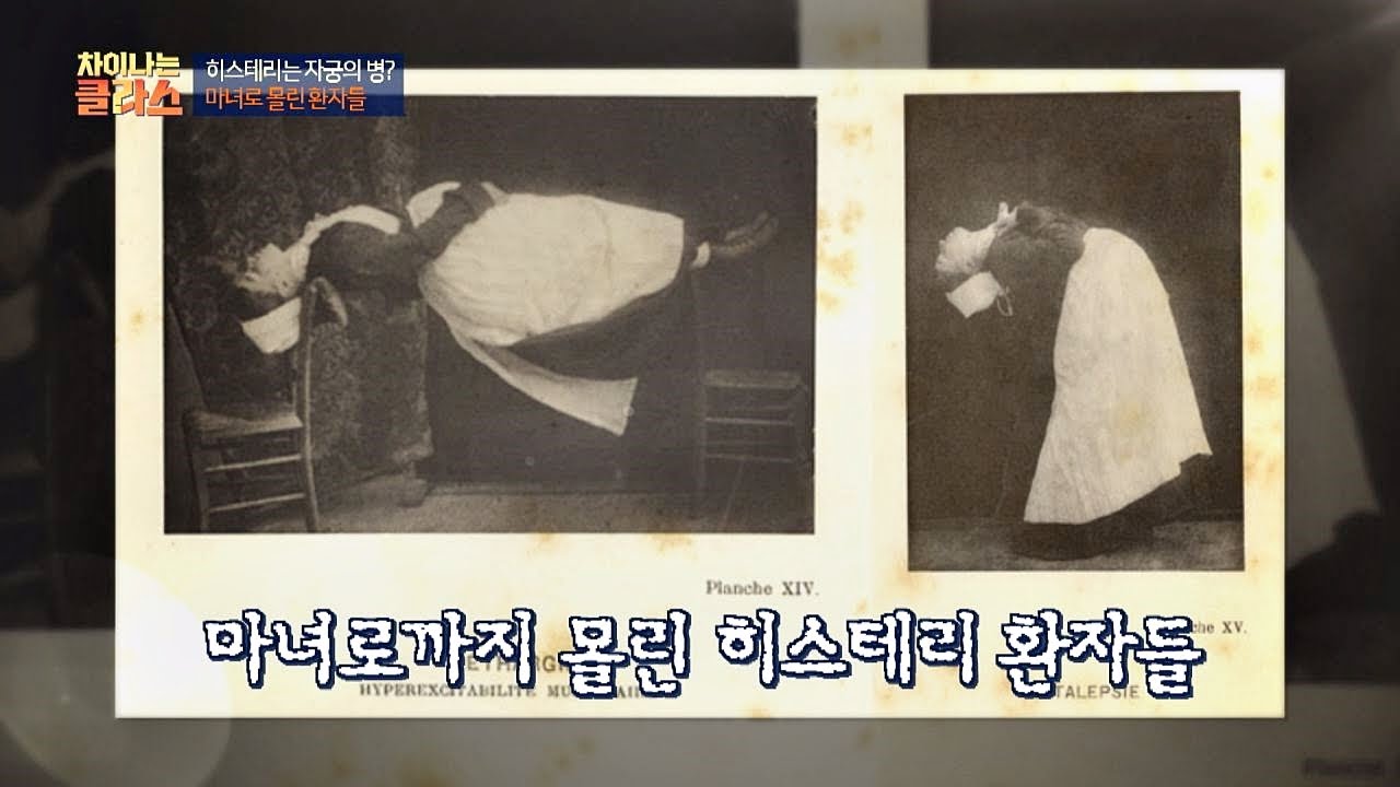 &prime;히스테리&prime; = 여성들의 전유물(?) &hellip; 마녀로 몰린 환자들 차이나는 클라스 103회
