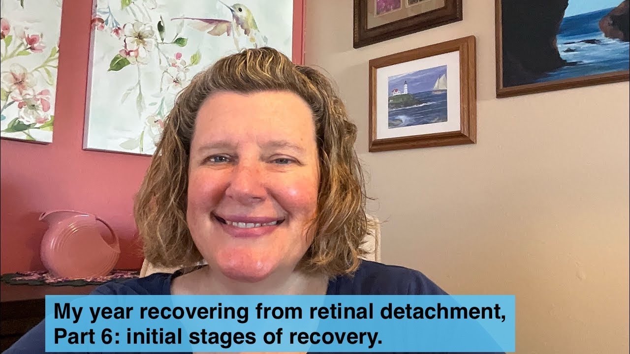 My year recovering from retinal detachment, part 6: Initial stage of recovery