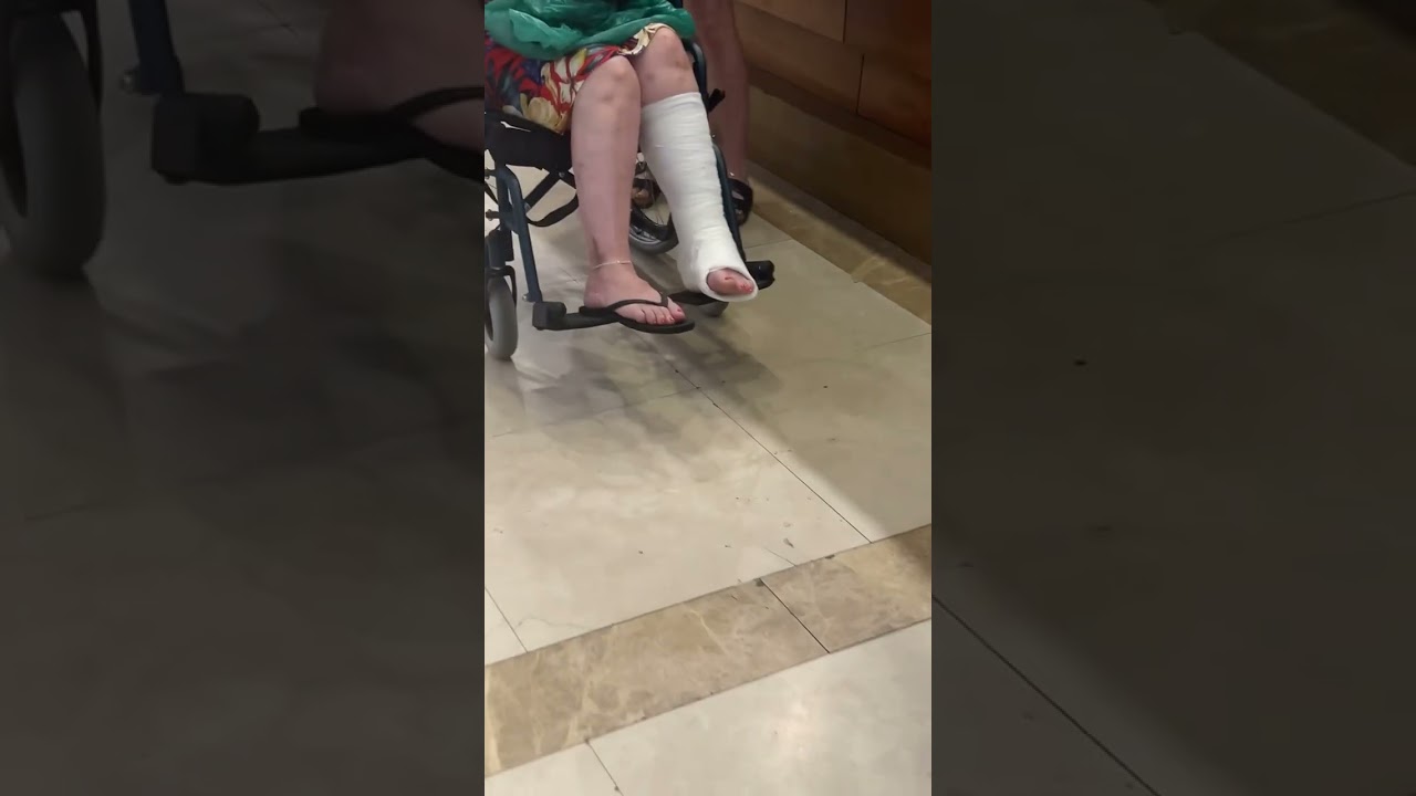 Candid mature leg cast #feet #legcast #brokenankle