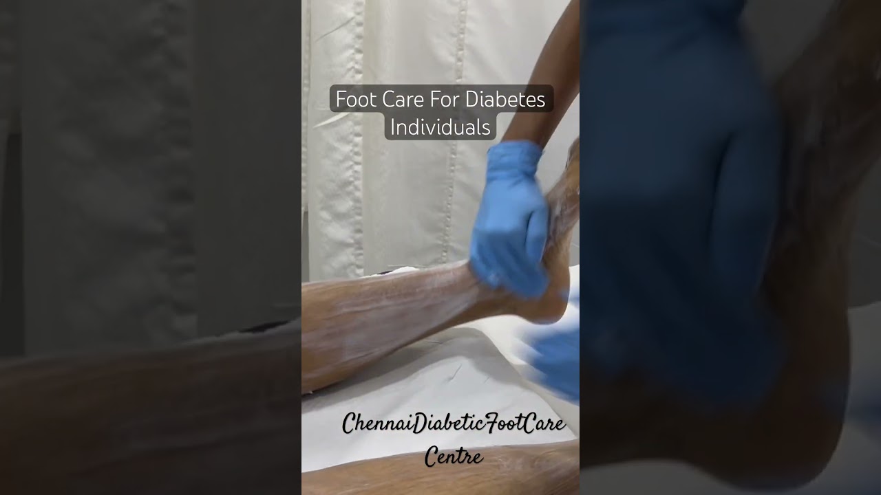 Moisturiser A Must For Diabetes Foot Care