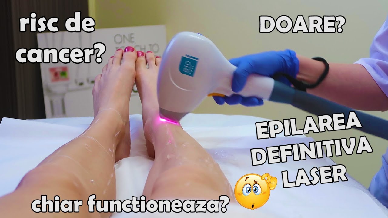 Epilarea DEFINITIVA. Tot ce trebuie sa stiti despre LASER