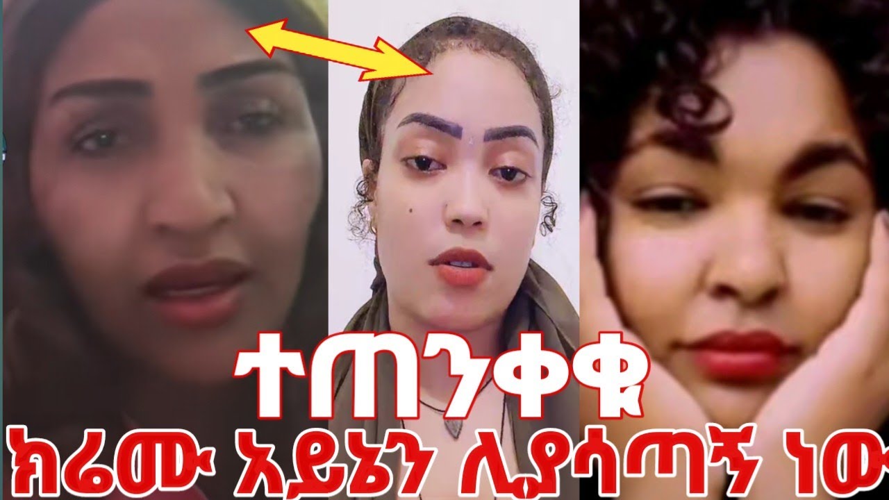 ተጠንቀቁ ክሬሙ አይኔን ሊያሳጣኝ ነው ሃኪም ሳያዝላችሁ አትግዙ #yeminorhiwet /Hiwi/
