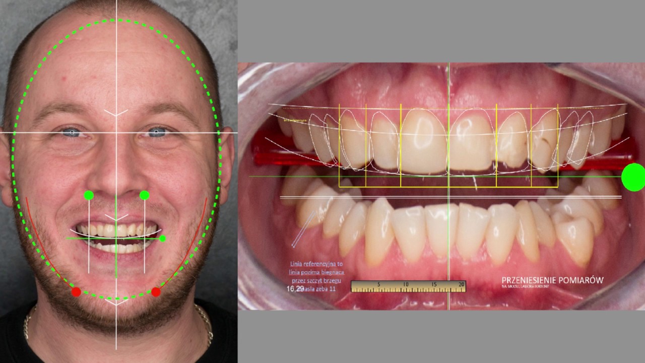 DIGITAL SMILE DESIGN