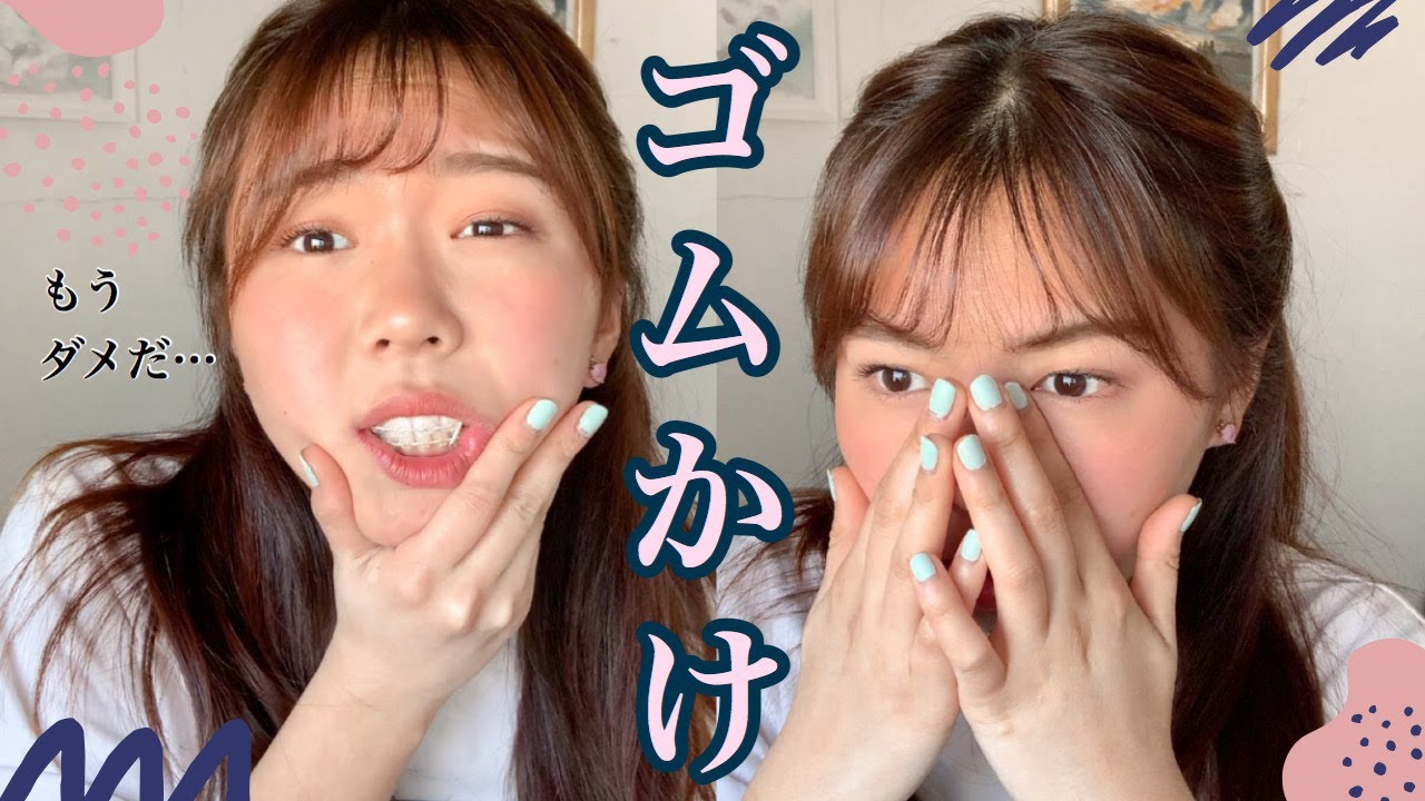 「なごの矯正日記#31」 顎間ゴムの掛け方が変わったんだけどさ...(掛け方種類）