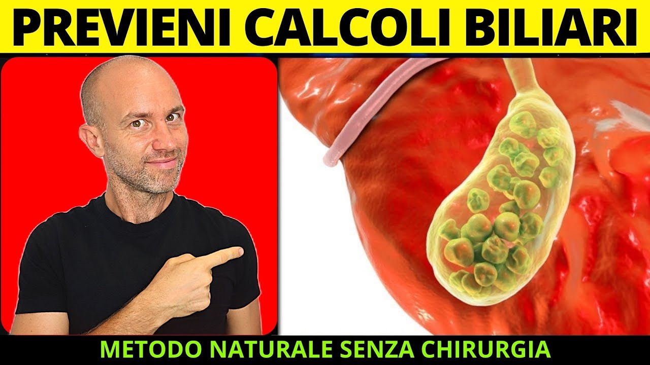PREVENZIONE dei CALCOLI BILIARI senza intervento chirurgico (CALCOLI in modo naturale ✔️)