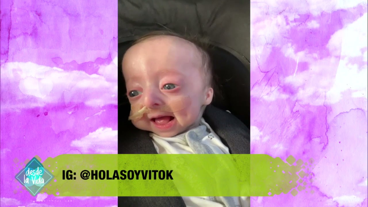 DESDE LA VIDA 23/10/21 Programa 628: “PROGERIA – ENVEJECIMIENTO PREMATURO EN NIÑOS” – Bloque 1