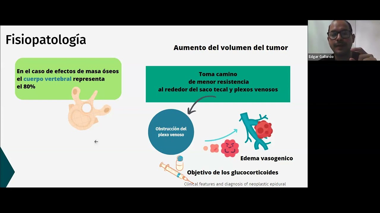 12    sindrome de comprension medular