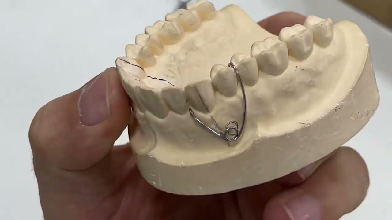 simple buccal canine retractoزت فلب سبرنك