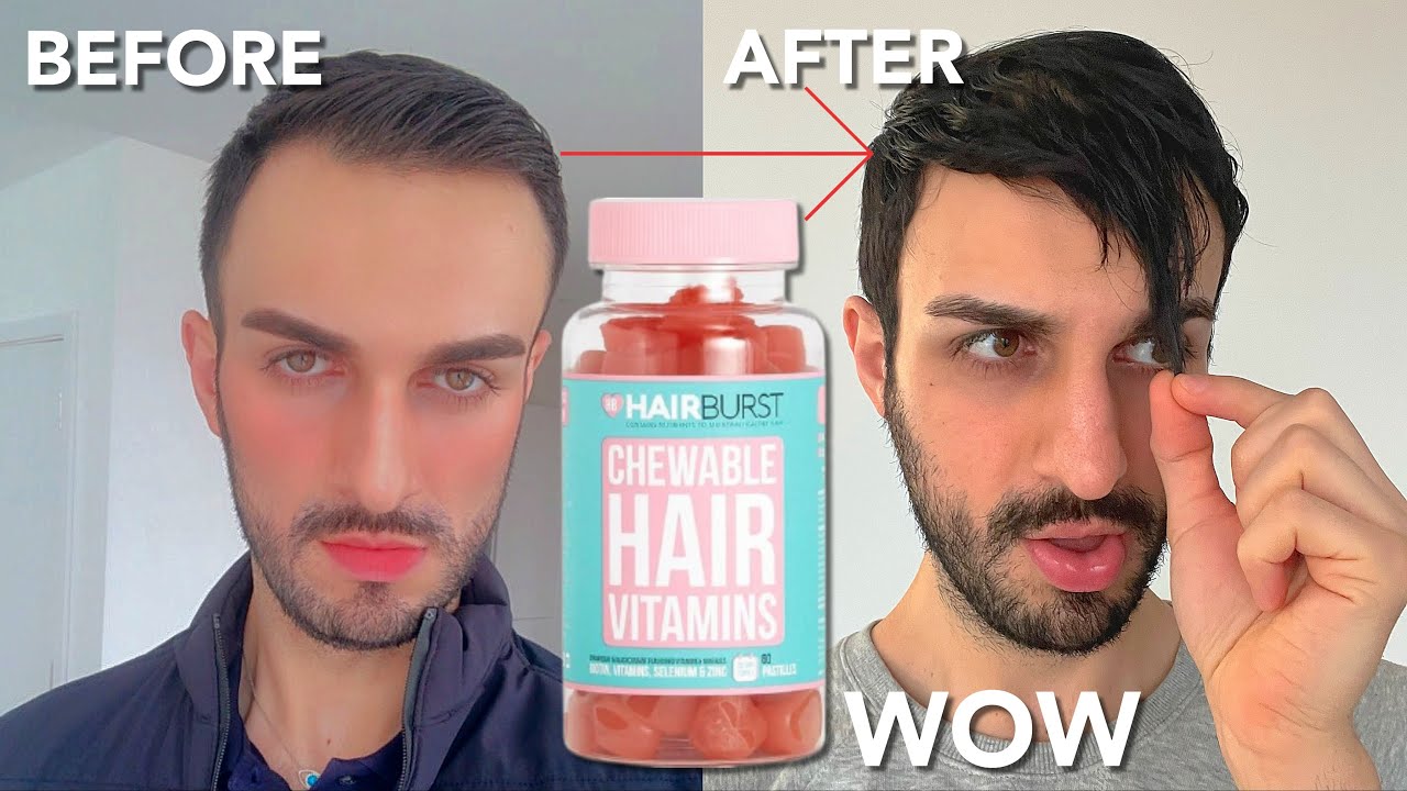 Супербыстрый рост волос за 3 месяца &mdash; жевательные витамины для волос Hairburst (ОБЯЗАТЕЛЬНО К ПРОСМОТРУ!)