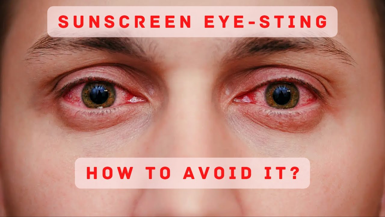Sunscreen's Eye-sting! HOW to minimize it? | 2022 sunscreen guide|