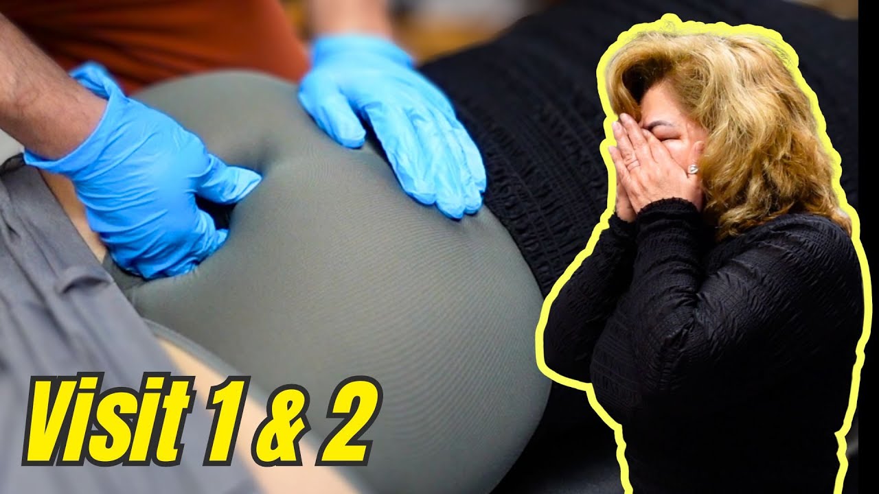 Internal COCCYX Adjustment | Couldn’t Sit For 2 Years Pt 1 & 2
