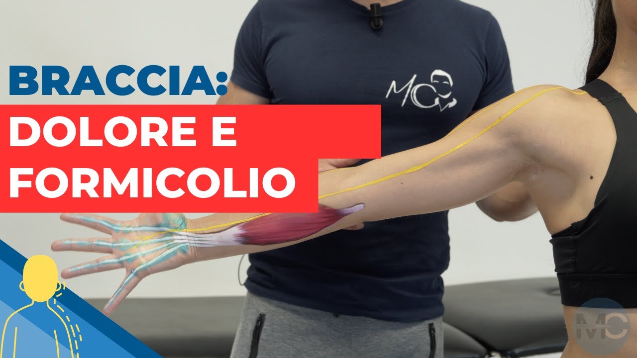 Come risolvere DOLORI e FORMICOLII alle braccia con lo STRETCHING dei NERVI