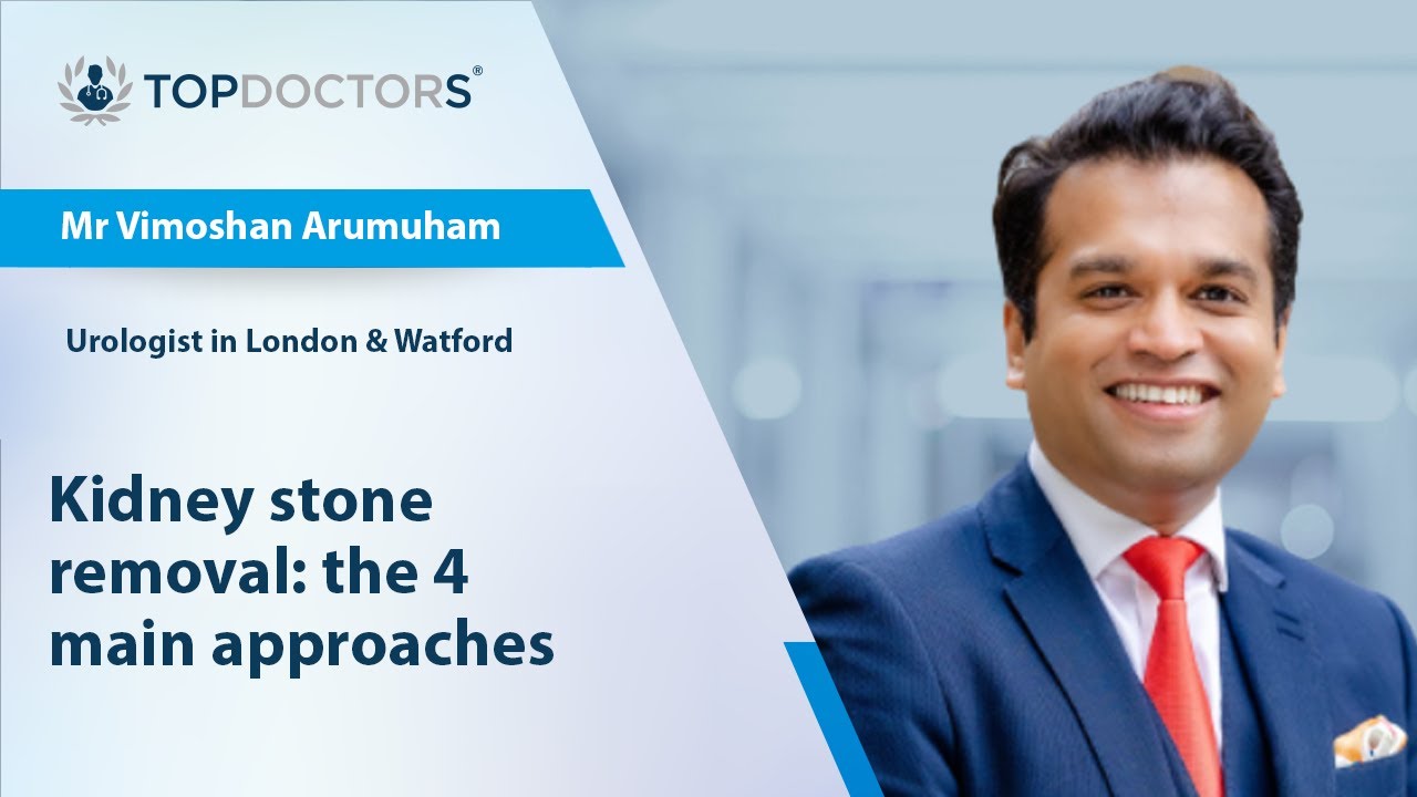 Kidney stone removal: the 4 main approaches - Online interview