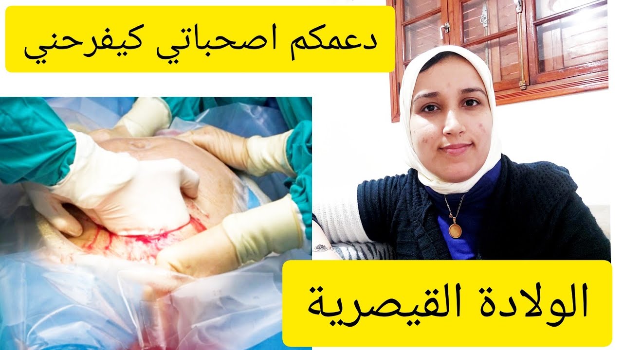 تجربتي مع الولادة القيصرية 🙅‍♀️ اشنو لي حسن ⁉️ تمن كل وحدة  #الولادة_القيصرية