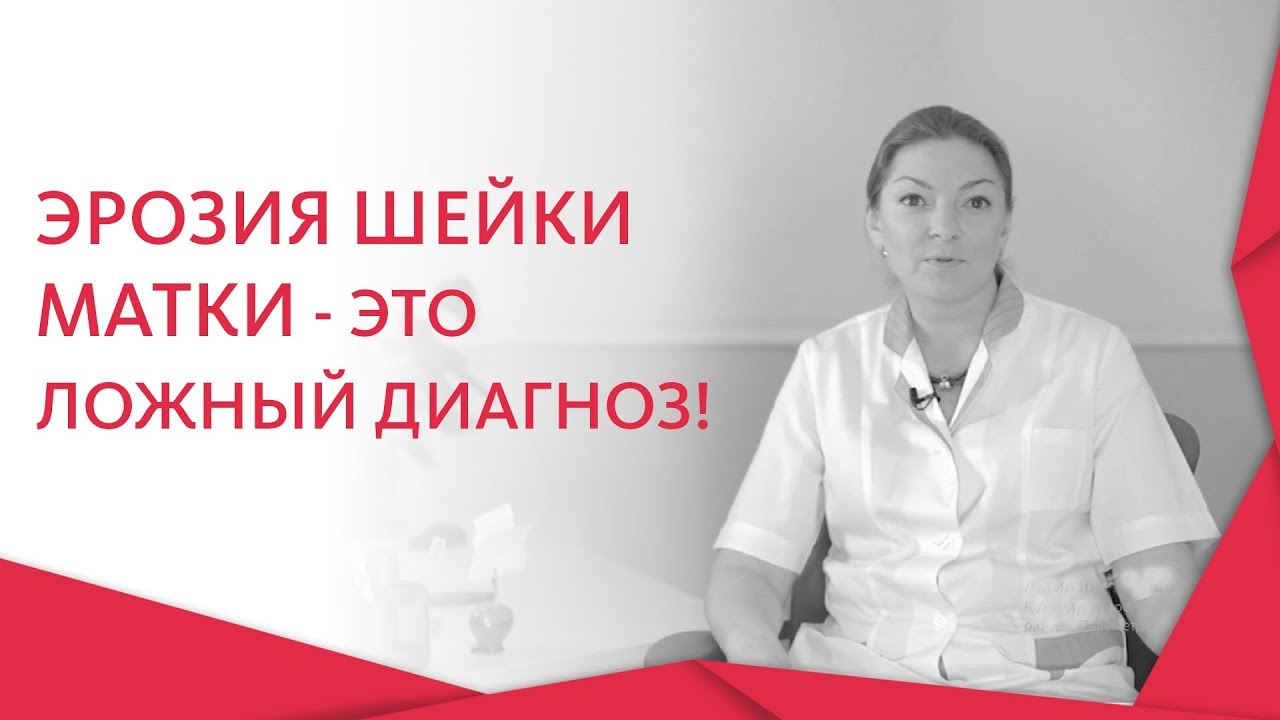 Эрозия шейки матки диагностика. 🥀 Почему врачи ставят неправильный диагноз: эрозия шейки матки? 12+