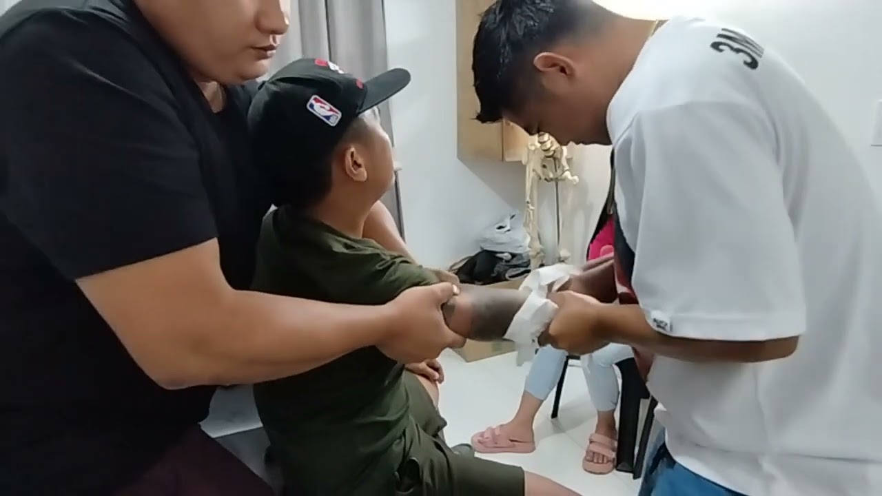 👉HIT AND RUN 😱 PATIENT 1 Month ago.. DISLOCATED ELBOW...namamaga pa..😱😱