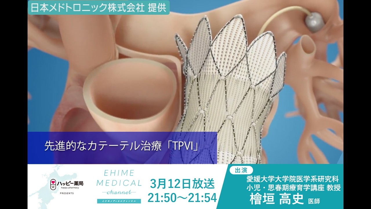 先進的なカテーテル治療「TPVI」　EHIME MEDICAL channel(3月12日放送)
