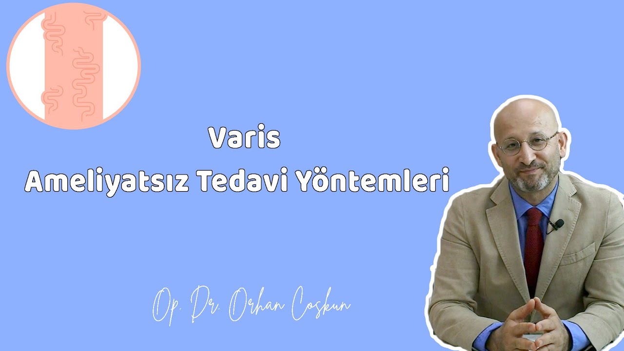 VARİS AMELİYATSIZ TEDAVİ Y&Ouml;NTEMLERİ - Op. Dr. Orhan Coşkun