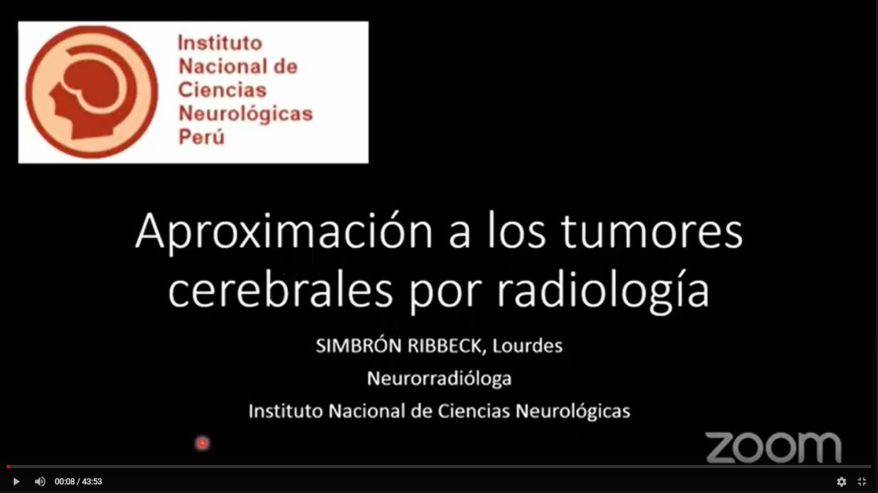 APROXIMACION NEURORADIOLÓGICA A LOS TUMORES DEL SISTEMA NERVISOSO CENTRAL