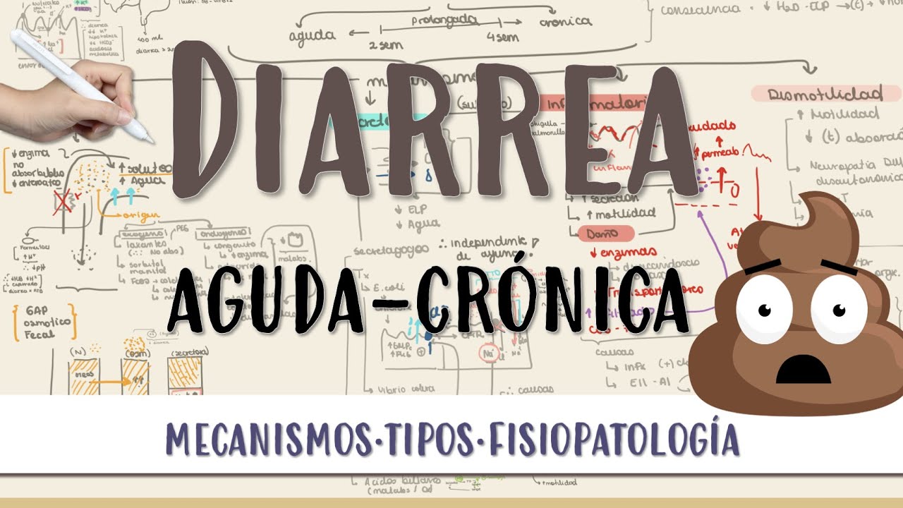 DIARREA #aguda #crónica #osmótica #secretora #inflamatoria #motilidad #dismotilidad