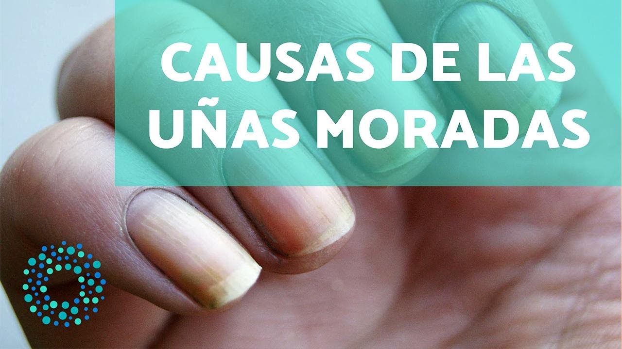 Por qu&eacute; se ponen las U&Ntilde;AS MORADAS - Causas y SOLUCIONES 💅🏼