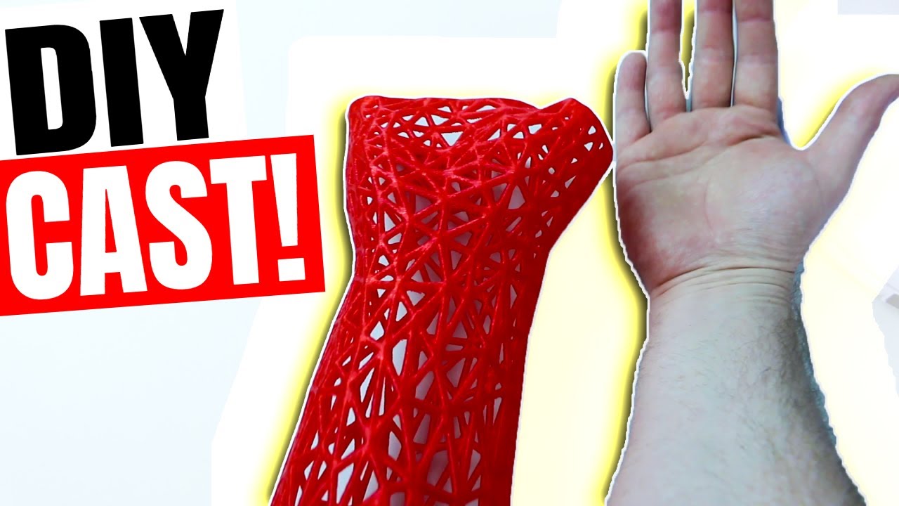 3D Scanning & Printing Medical Equipment With an Xbox Kinect