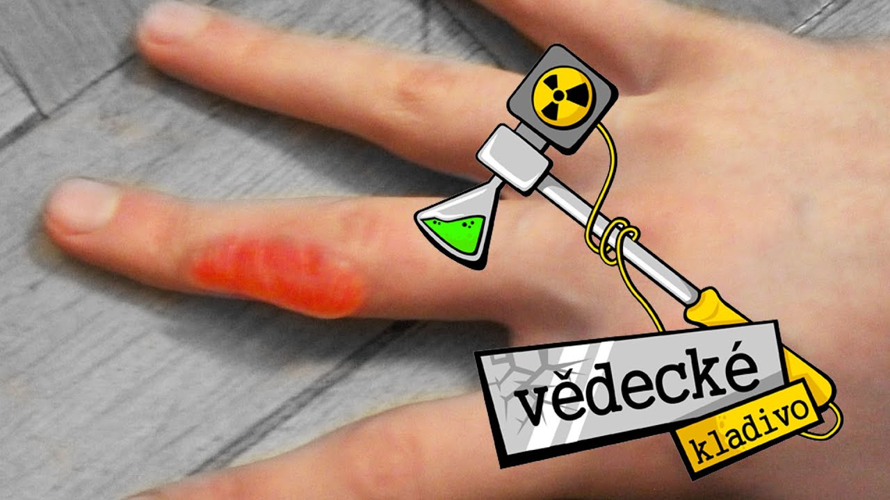 Jak se tvoří puchýře a mozoly? - Vědecké kladivo