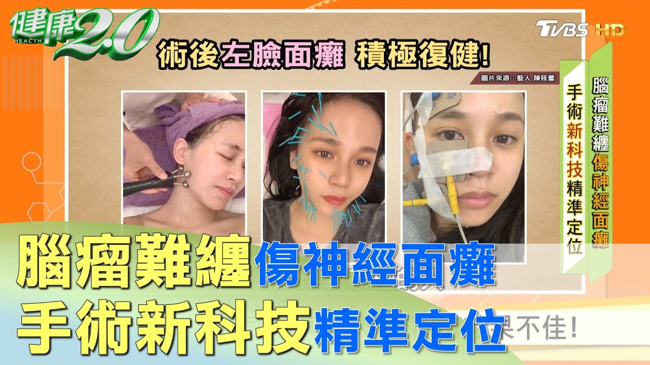 歷經13小時開顱手術 聽力未恢復.左臉面癱！ 健康2.0