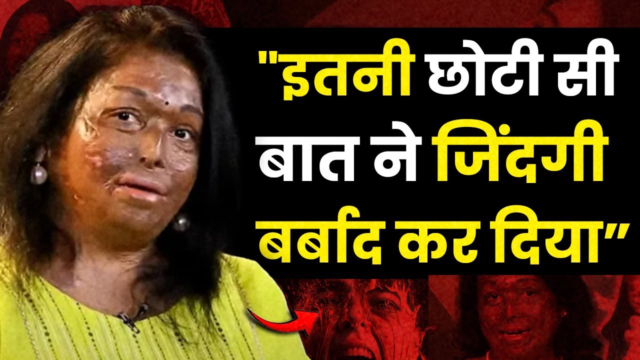 उसने एक मिनट में मेरी life बर्बाद कर दी | Sneha Jawle | Acid Attack Survivor | Josh Talks Hindi