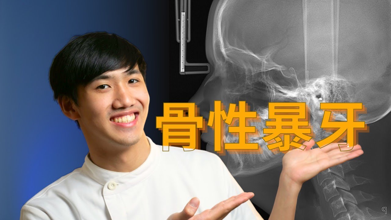 骨性暴牙是什麼？骨暴不是牙齒矯正就能解決！？