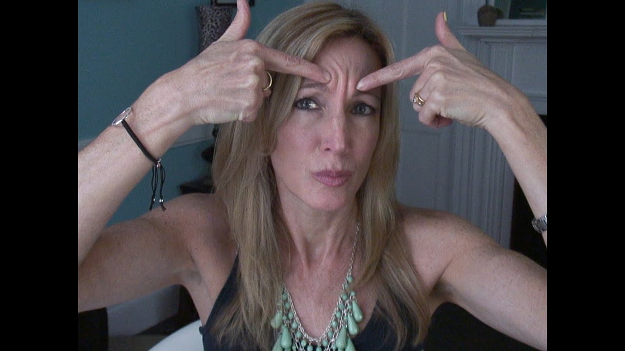 My Experience With Botox for Forehead Wrinkles