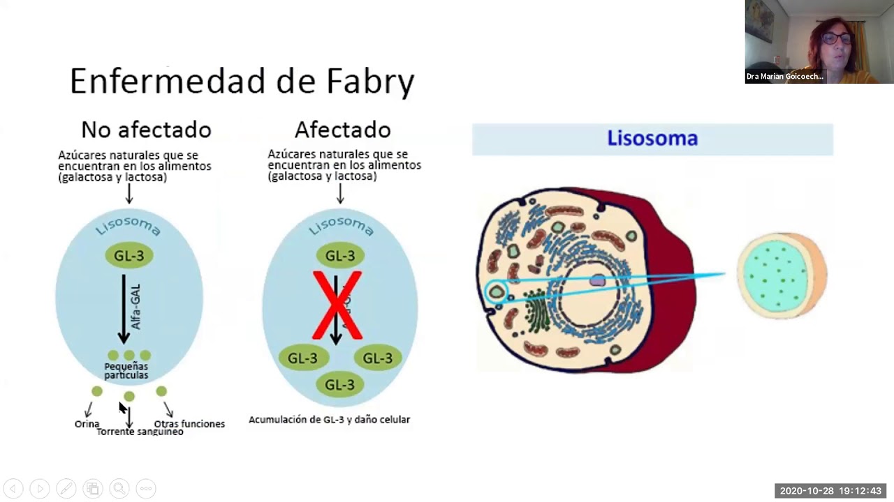 Compartiendo Salud MPS Espa&ntilde;a | El papel de lisoGb3 en el diagn&oacute;stico y seguimiento de Fabry