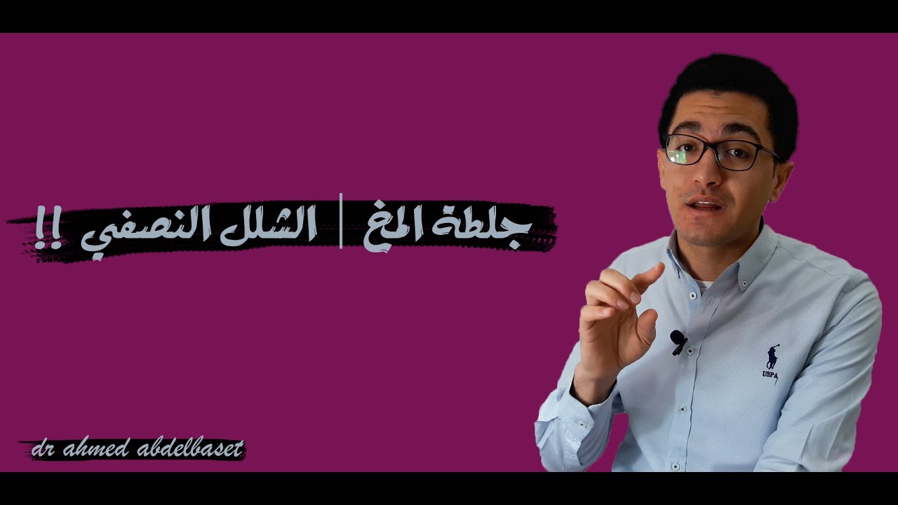 ايه هو الشلل النصفي ومصيره | الجلطة | دكتور احمد عبدالباسط