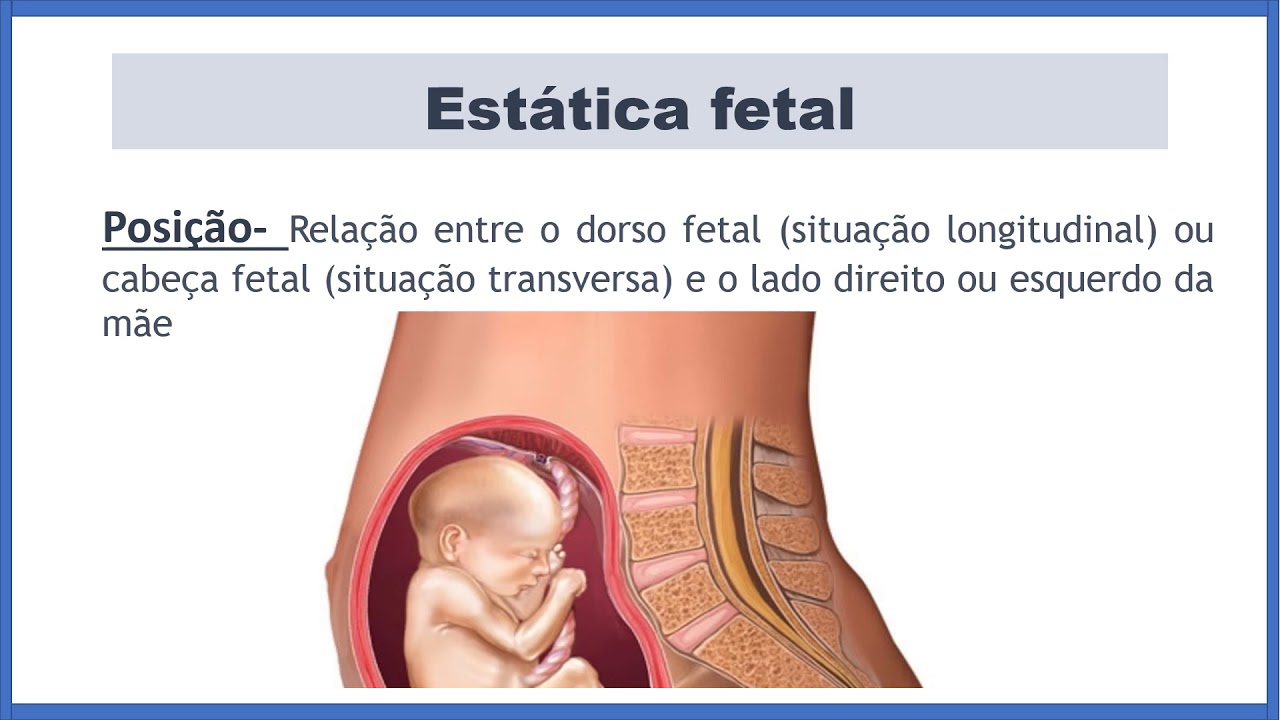 Estática fetal profa. Rachel.