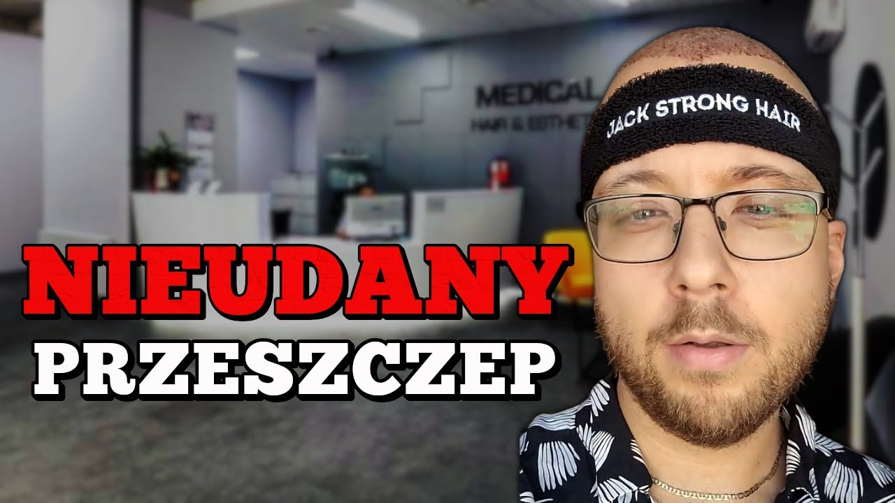 jak demonz stracił włosy - smutna historia kamila amraha