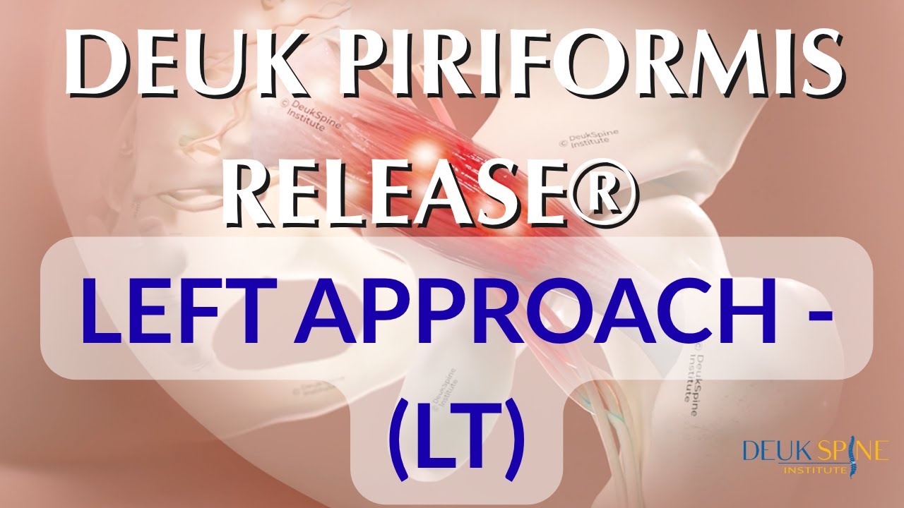 PIRIFORMIS MUSCLE SYNDROME - LIVE - Laser Spine Surgery