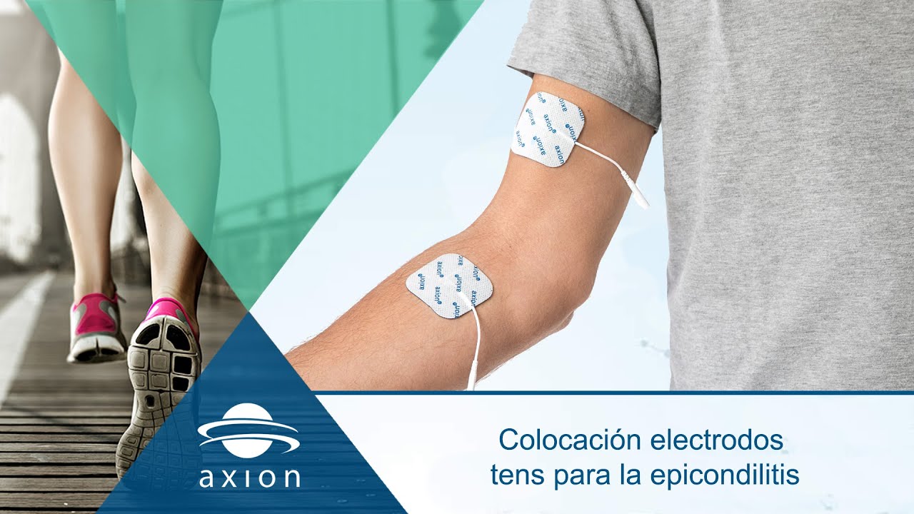 Colocación electrodos TENS para codo golfista o epicondilitis | Electroestimulación terapia TENS