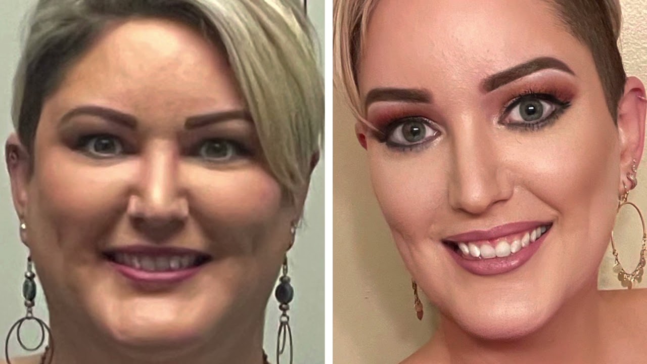 100 POUND WEIGHT LOSS!