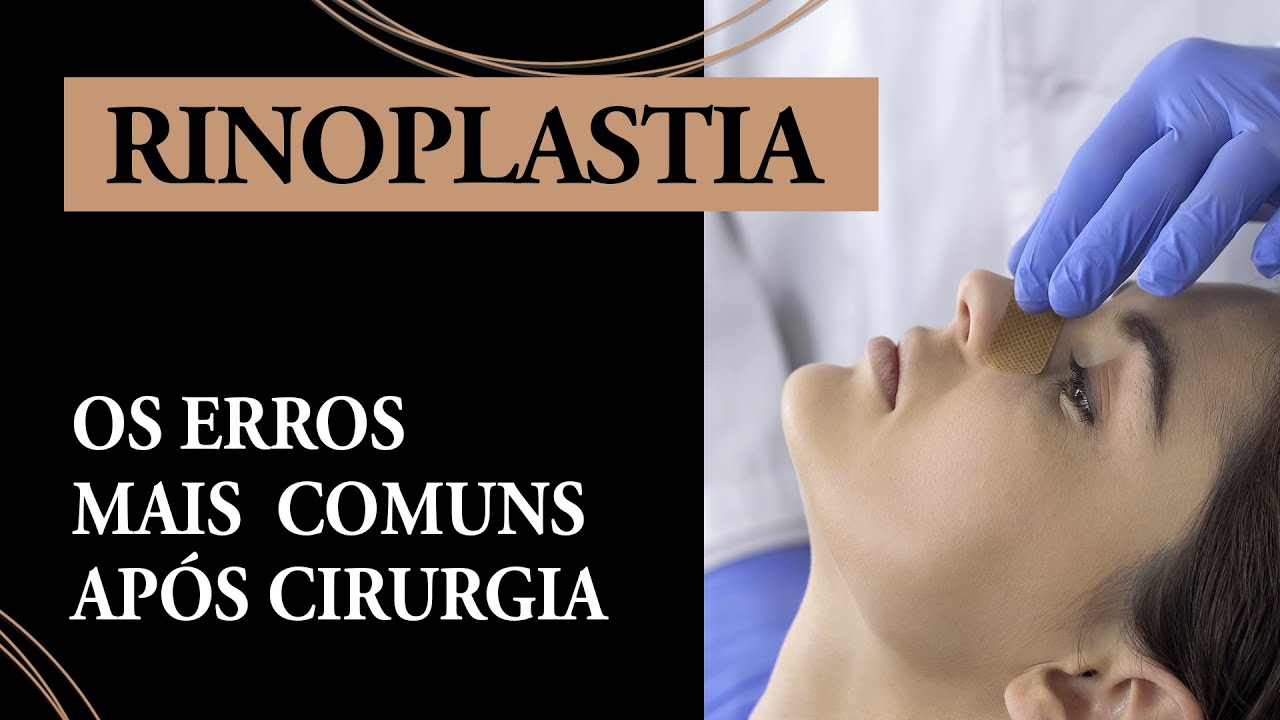 Os erros mais comuns após a Rinoplastia - Dr. Fábio Maniglia