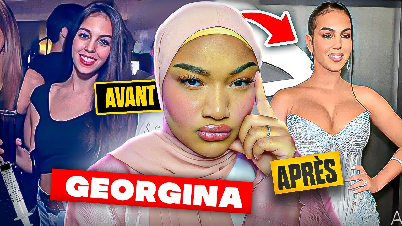 GEORGINA RODRIGUEZ : SA TRANSFORMATION GRÂCE A LA CHIRURGIE!!😱👀