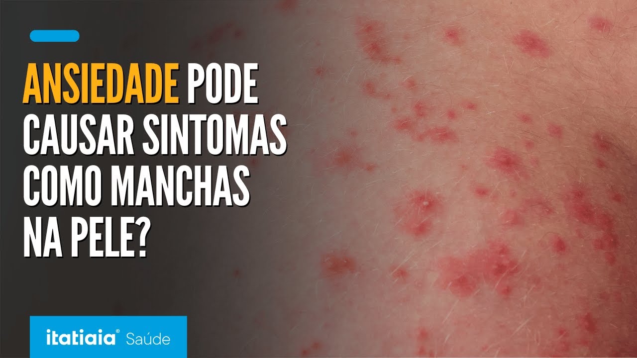 Saúde Mental: a ansiedade pode causar sintomas físicos como manchas na pele? Entenda!