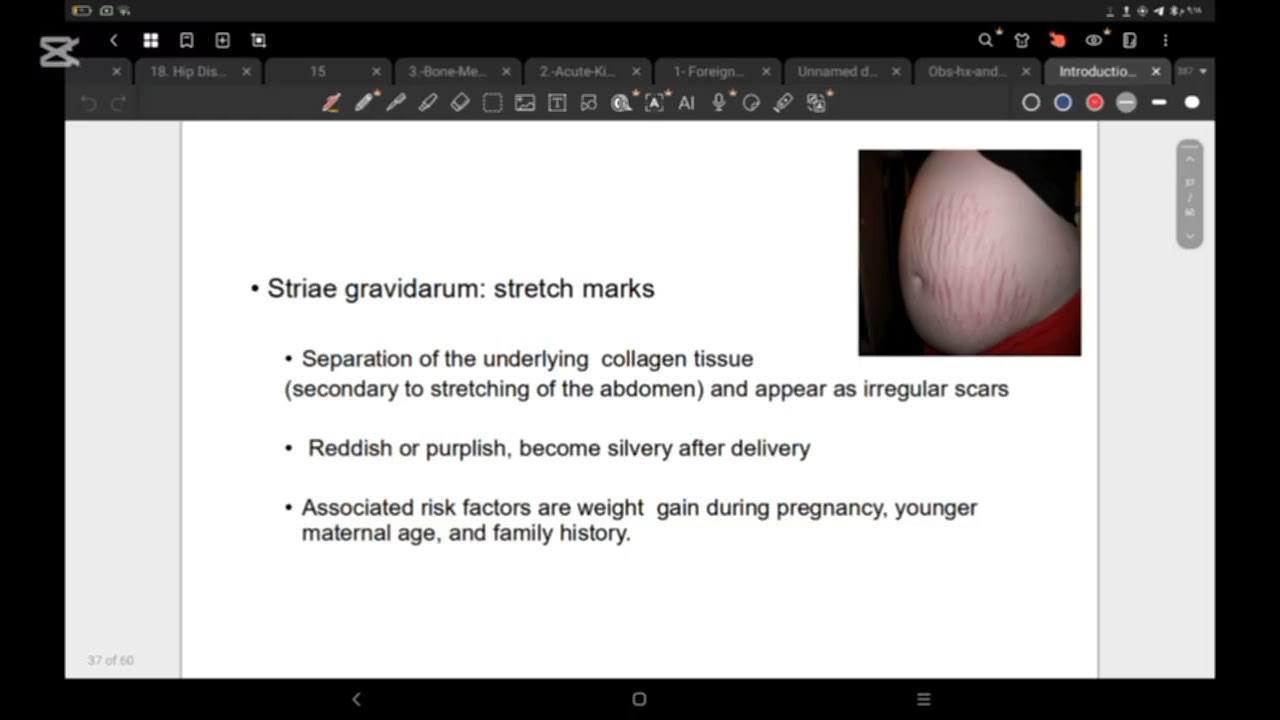 Obs & gyne PE
