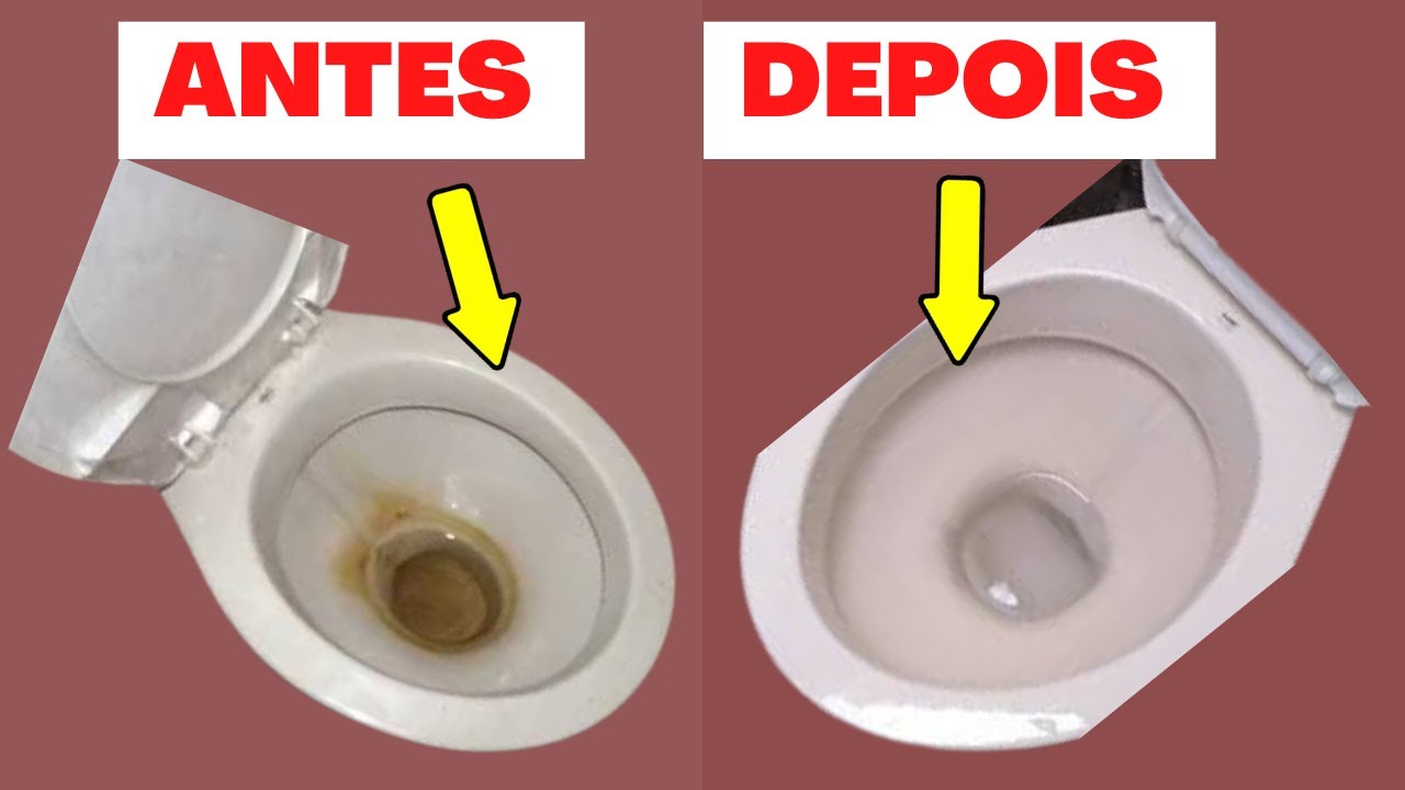 Como limpar vaso sanitário encardido com crosta no fundo, sem esforço.