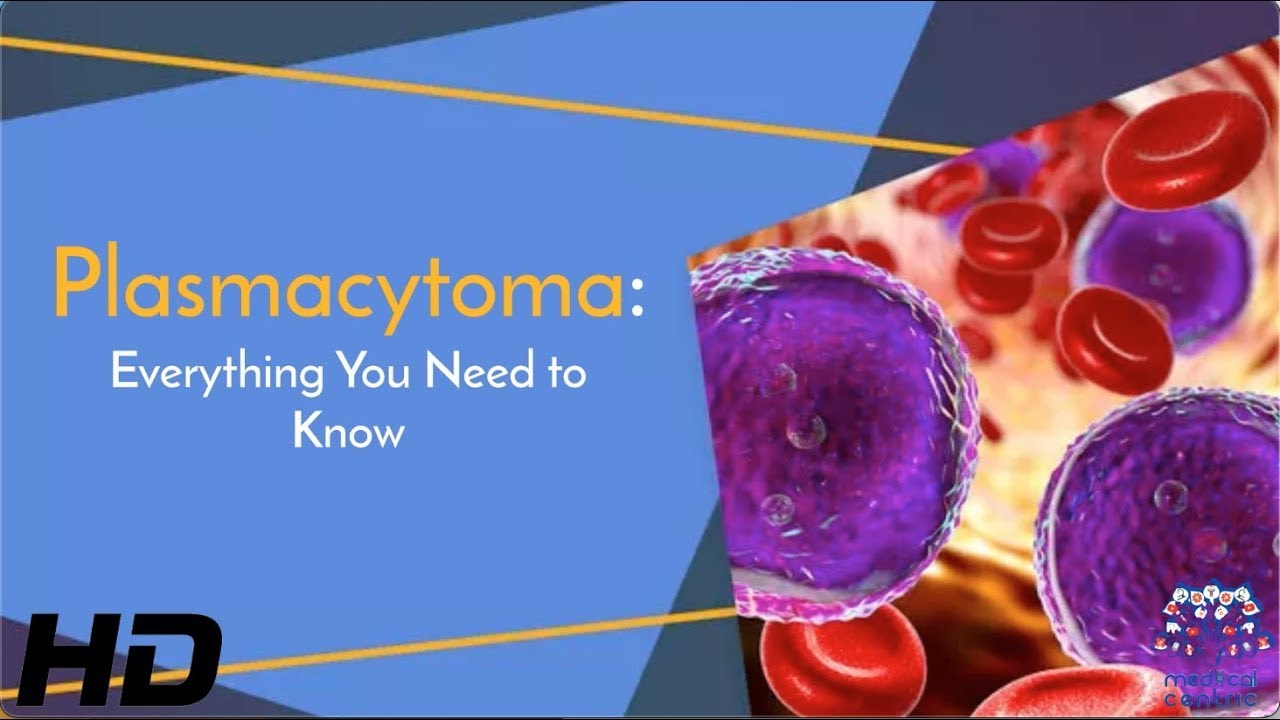 Plasmacytoma: The Silent Cancer You Need to Know About