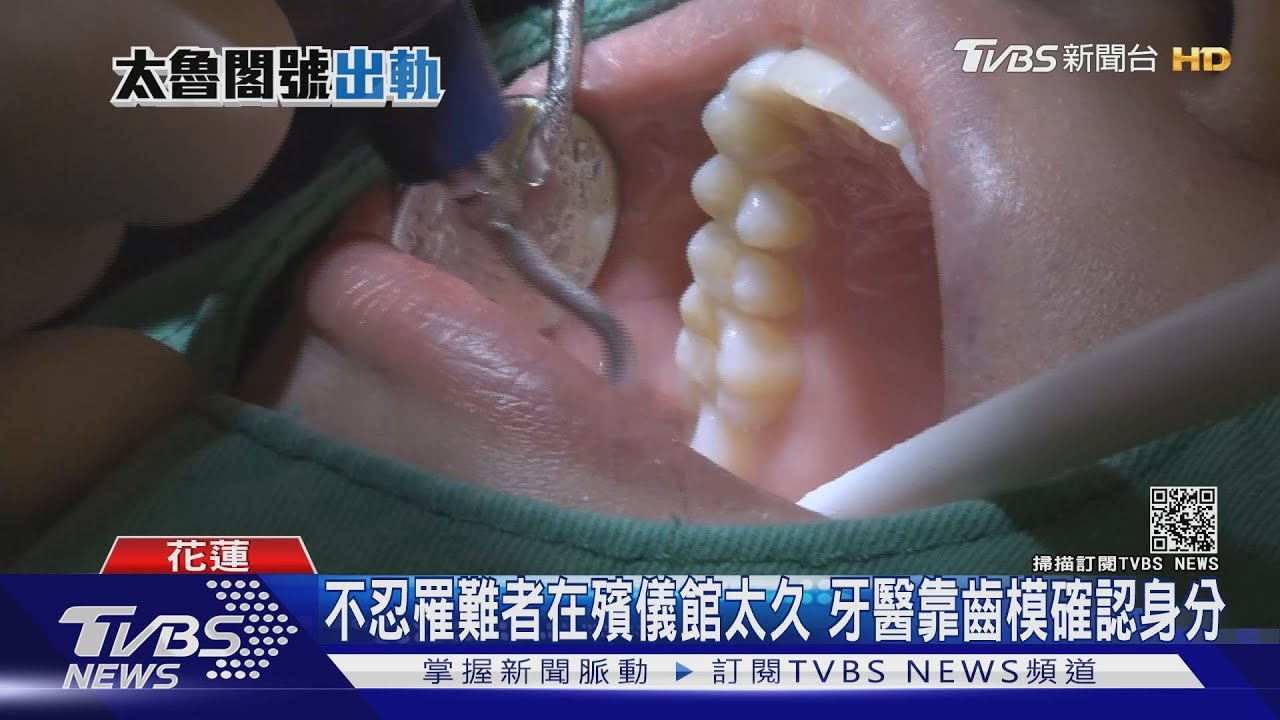 太魯閣罹難者容貌難辨識 牙醫靠齒模成功比對身分｜TVBS新聞