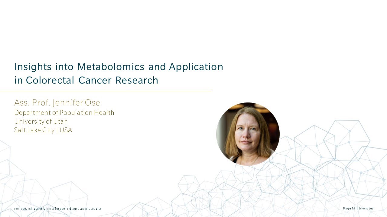 Metabolomics and Application in colorectal cancer research