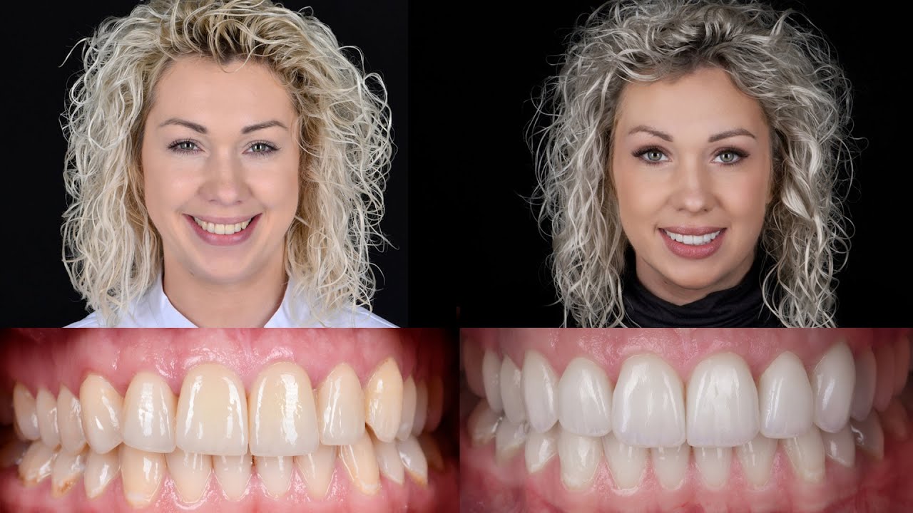 PACJENCI CHCĄ MIĘĆ TAKIE SAME ZĘBY JAK JA! - DENTYSTKA NA FOTELU